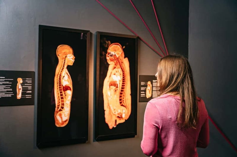 Berlin: Tickets for the BODY WORLDS Museum in Berlin - Who should book (and who might want a different plan)